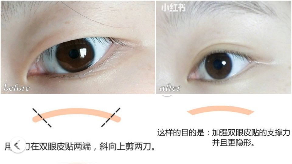 大小眼、單眼皮、內雙都有救！不同眼型的「雙眼皮貼」貼法～加碼推薦超自然雙眼皮貼