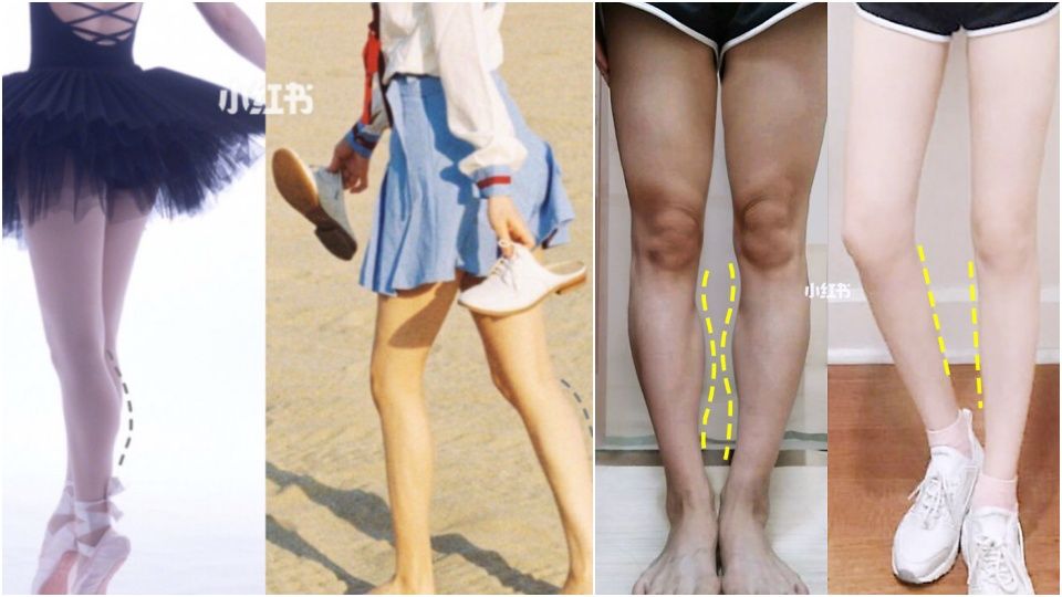 腿粗還分「脂肪型、水腫型」？不同腿搭配不同運動，1周速成腿精～