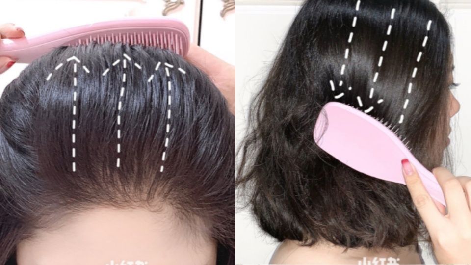狂掉髮怎麼辦？5步驟預防掉髮，拯救頭頂明顯分線，讓髮際線不再高！