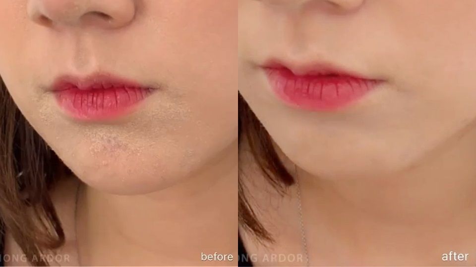 韓國彩妝師親授瑕疵皮「脫皮浮粉」急救法！補完妝超貼、超無瑕～再也不怕脫妝找上門！