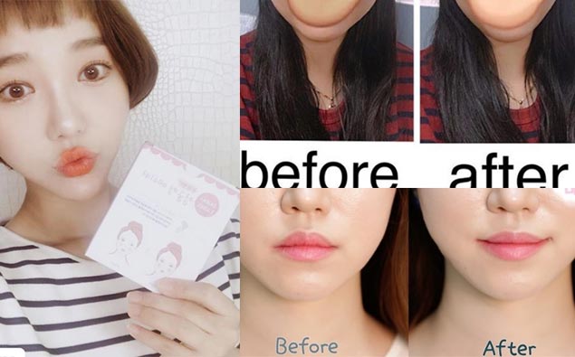 追求小臉無極限！韓國推出小臉隱形OK蹦，一貼秒變V臉！