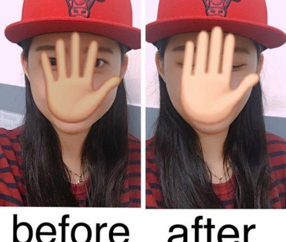 追求小臉無極限！韓國推出小臉隱形OK蹦，一貼秒變V臉！