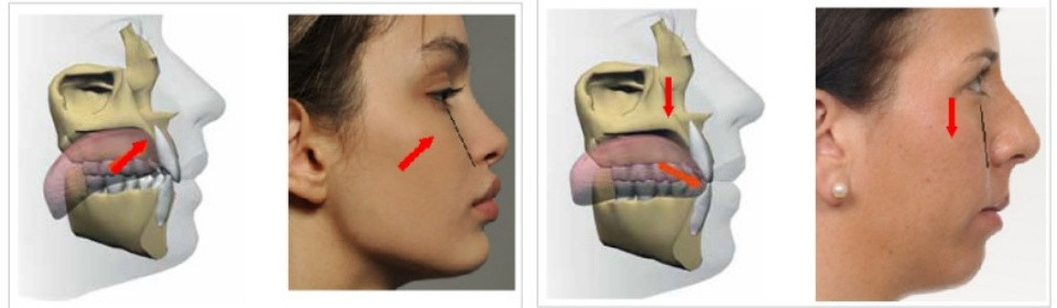 牙醫師：舌頭放對位置，輕鬆瘦雙下巴、五官變立體！國外瘋Mewing，小習慣就有整型效果
