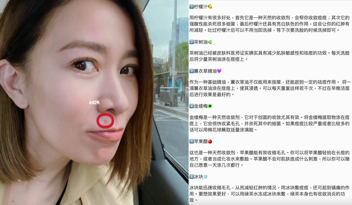 佘詩曼消痘痘/保養秘訣