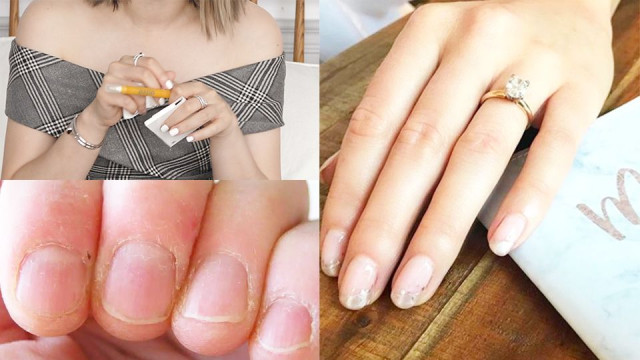 指甲旁邊都會翹起來？這幾款指緣油，凱文老師、眾女星超愛用！