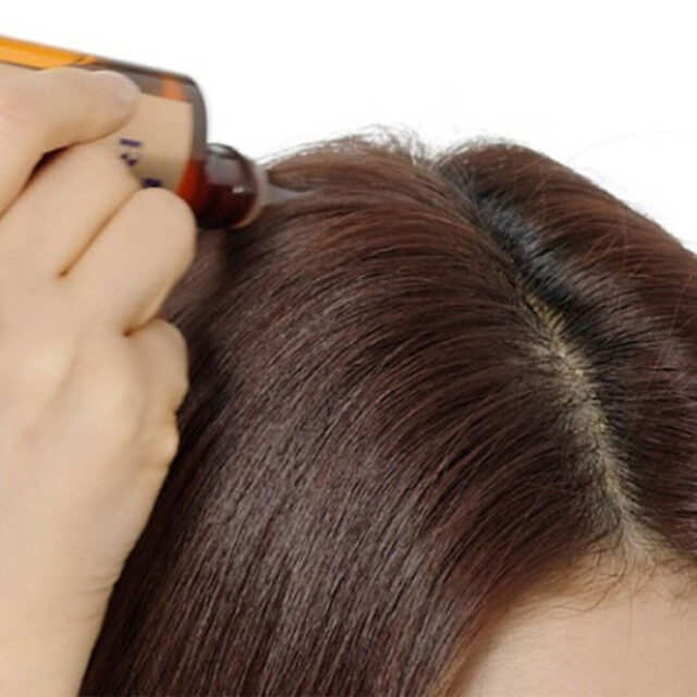 2026頭皮水推薦15款！頭皮水功效、怎麼用？控油養髮，有效拯救髮際線！